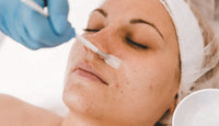 Acne Boot Camp