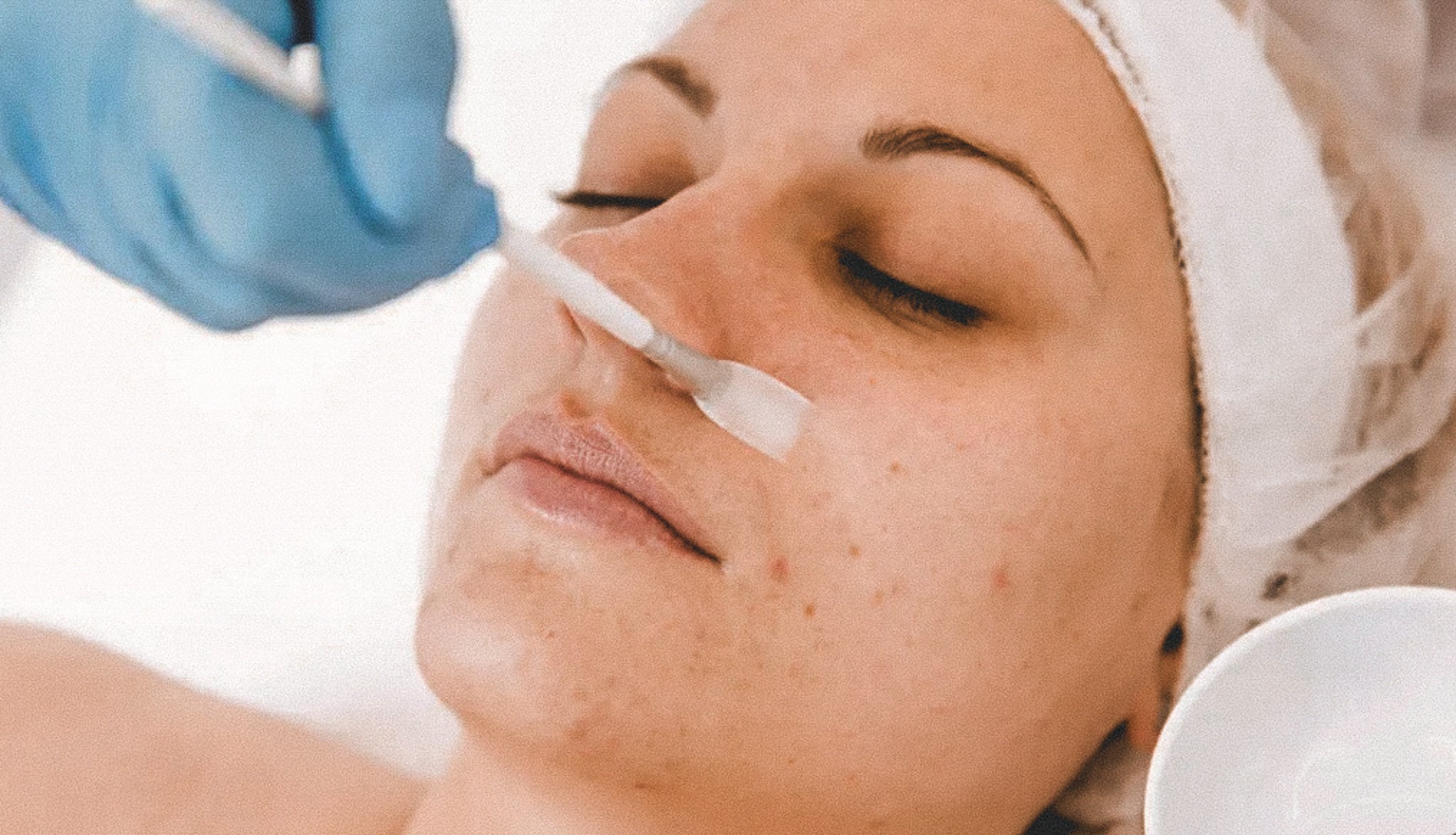 Acne Boot Camp