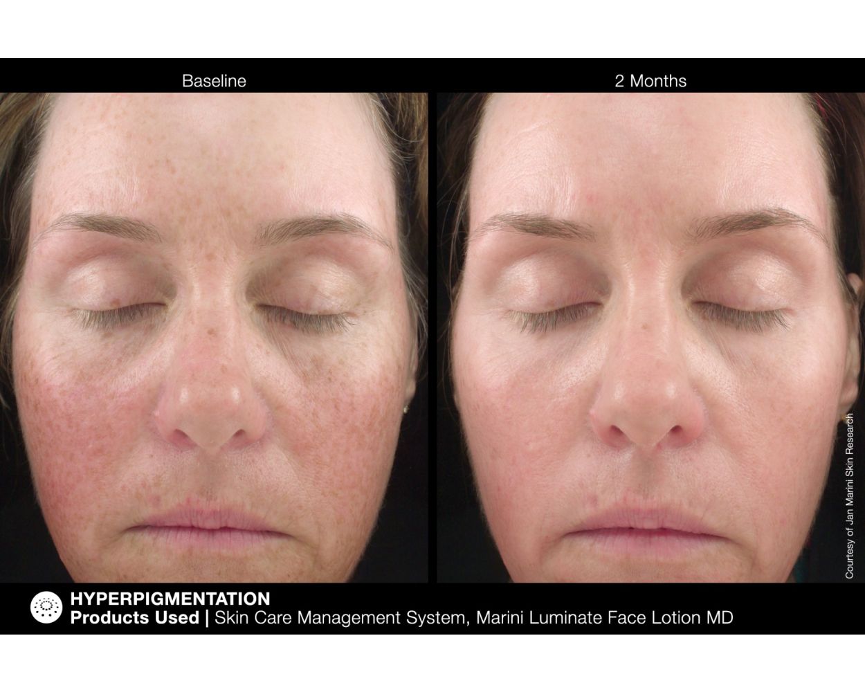 Marini Luminate® Face Lotion MD