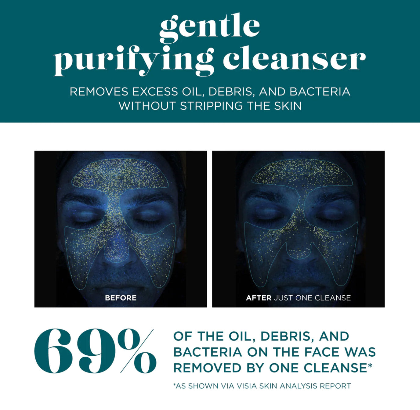 vi Peel Vitality Institute Gentle Purifying Cleanser